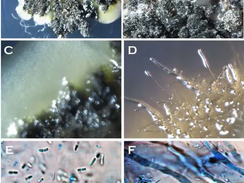 Mycosphaerella capsellae