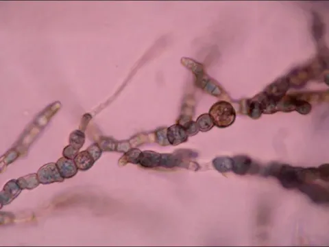 Dematiaceous fungi