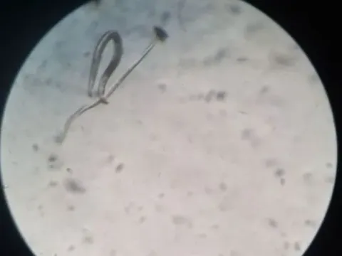 Wheat seed gall nematode