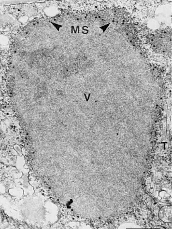 Oat sterile dwarf virus