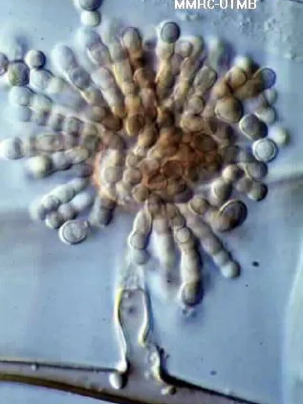 Syncephalastrum