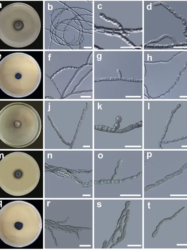 Chaetothyriales fungi