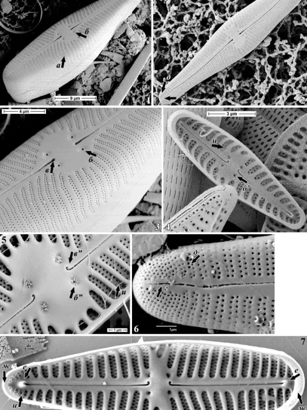 Gomphonema parvum