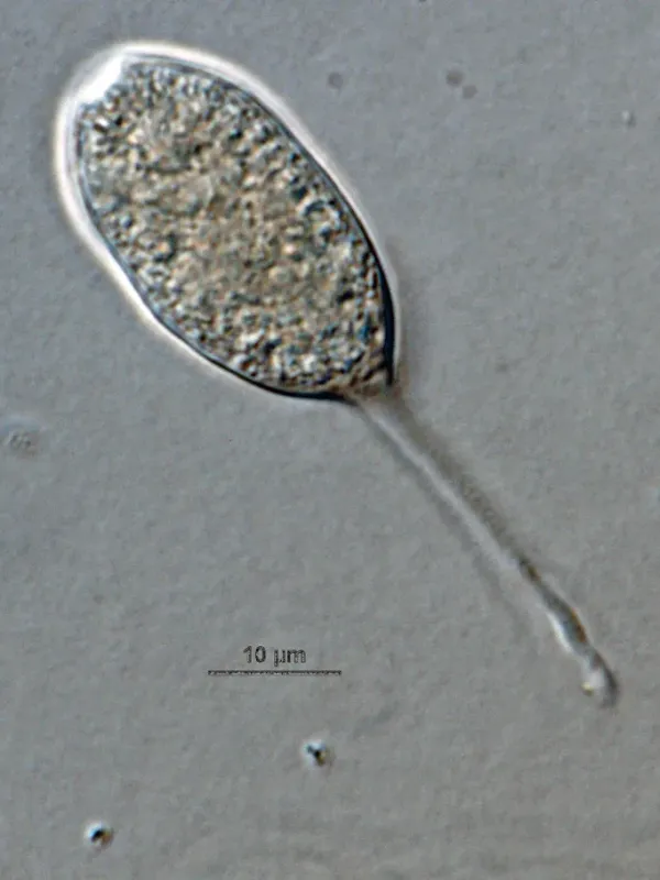 Phytophthora brown rot of citrus
