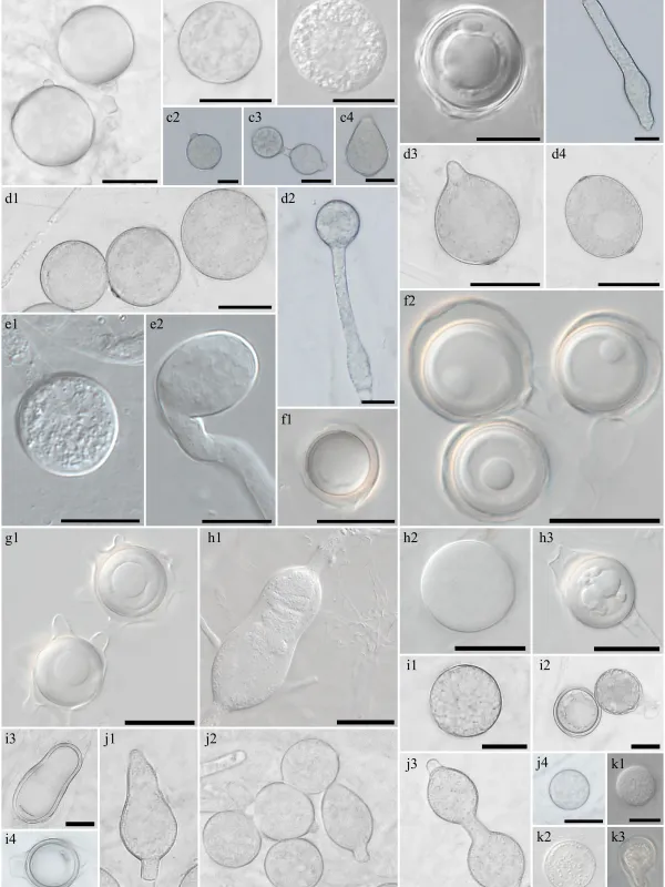 Globisporangium irregulare