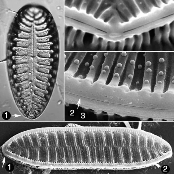 Surirella