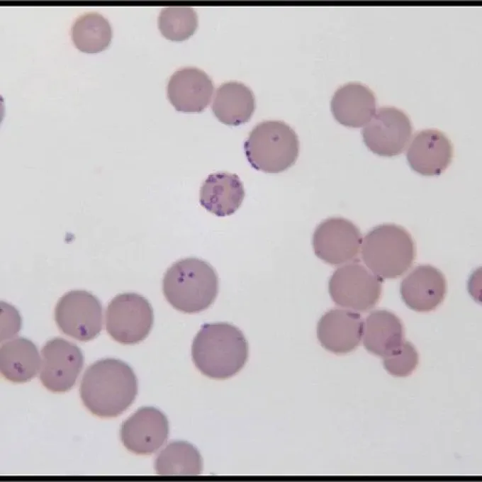 Hemobartonellosis