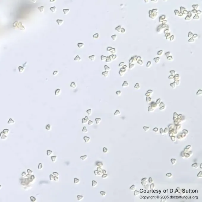 Microascus root rot