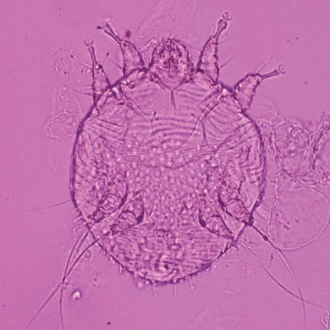 Rabbit fur mite