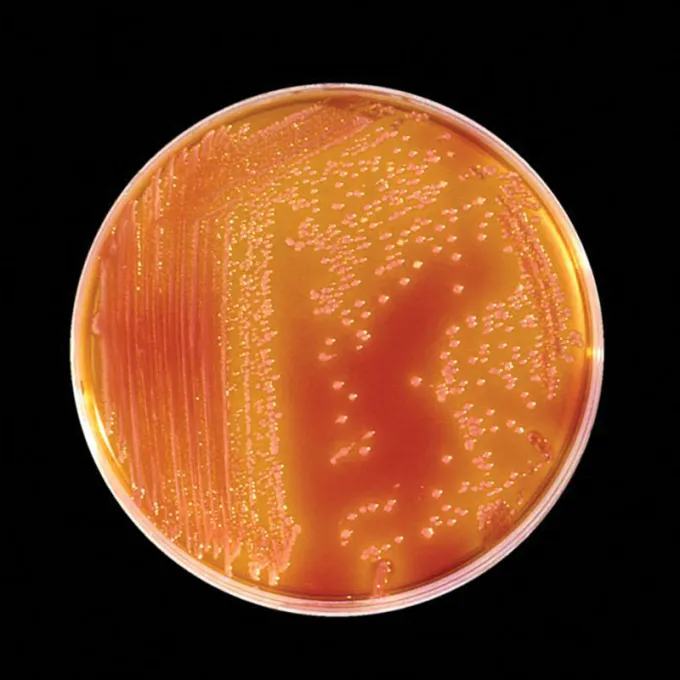 Serratia marcescens