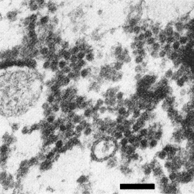 Beet western yellows virus