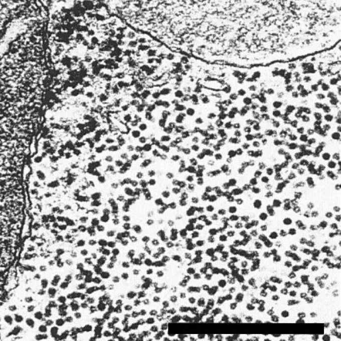 Blackgram mottle virus