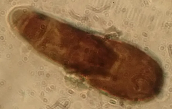 Corynespora leaf spot