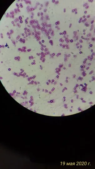 Azotobacter vinelandii