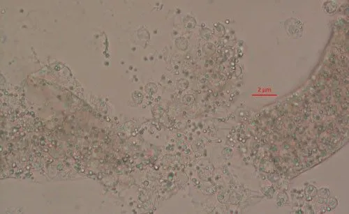 Pasteuria