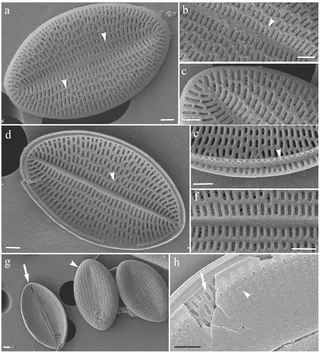 Cocconeis