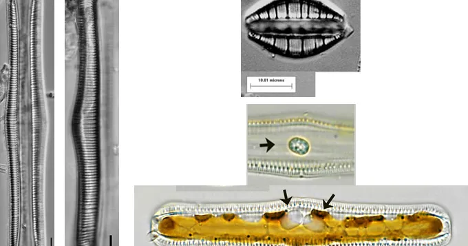 Rhopalodia