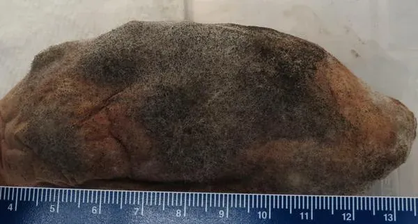 Rhizopus rot