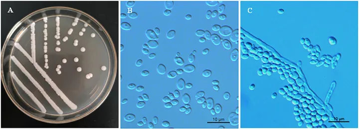Clavispora lusitaniae