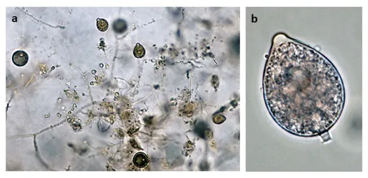 Фітофтороз Phytophthora hedraiandra
