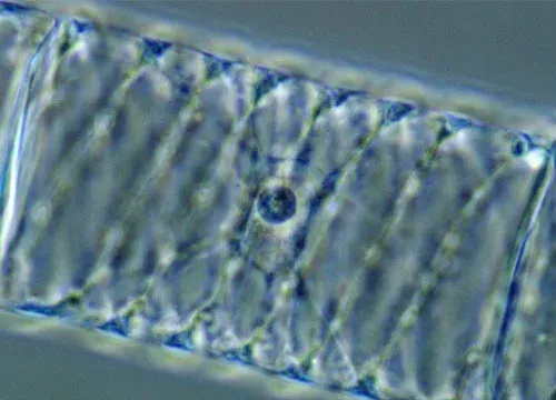 Spirogyra crassa