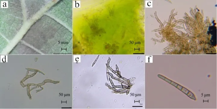 Pseudocercospora