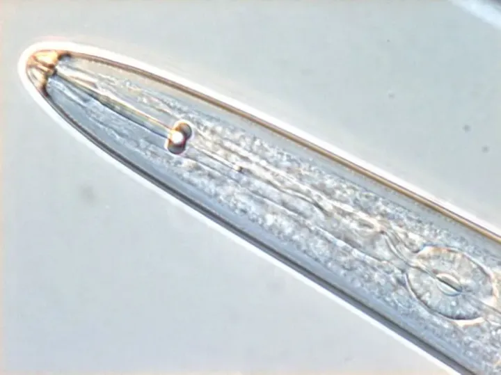 Spiral nematode