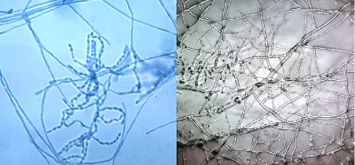 Streptomyces