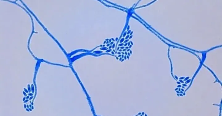 Cephalosporium apii