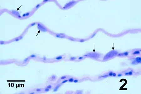 Rickettsia-like organisms