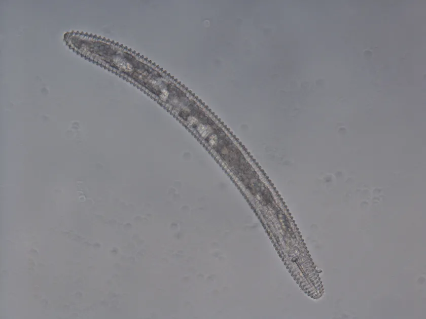 Ring nematode