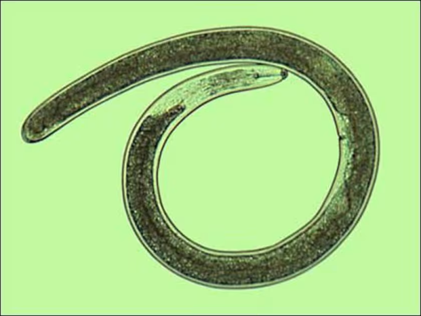 Lance nematode
