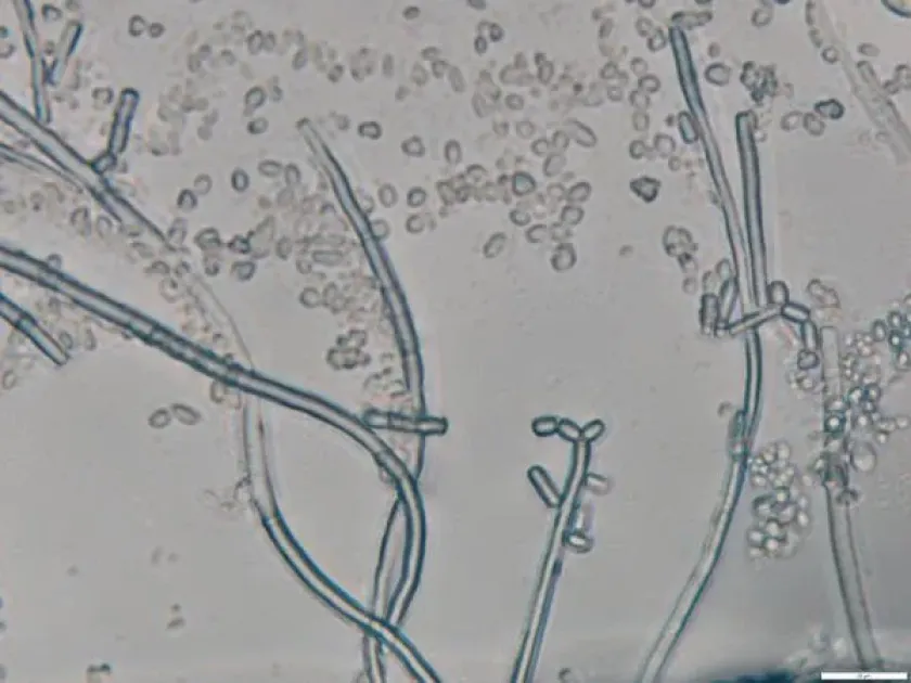 Geotrichum rot