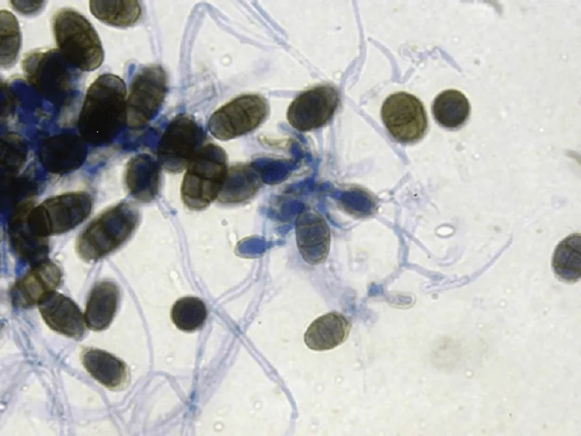 Pseudopithomyces sacchari