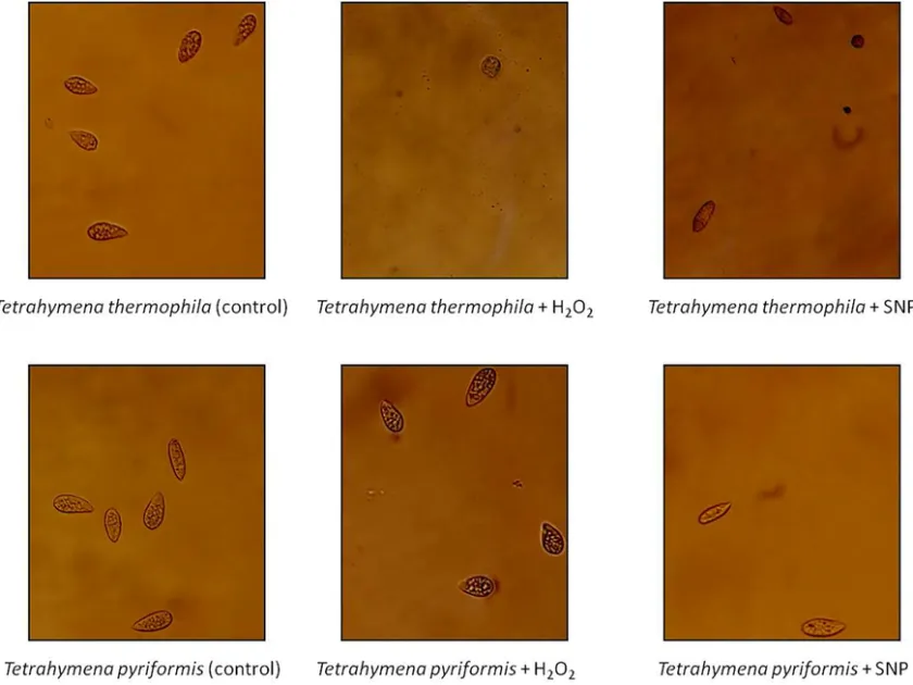 Tetrahymena thermophila
