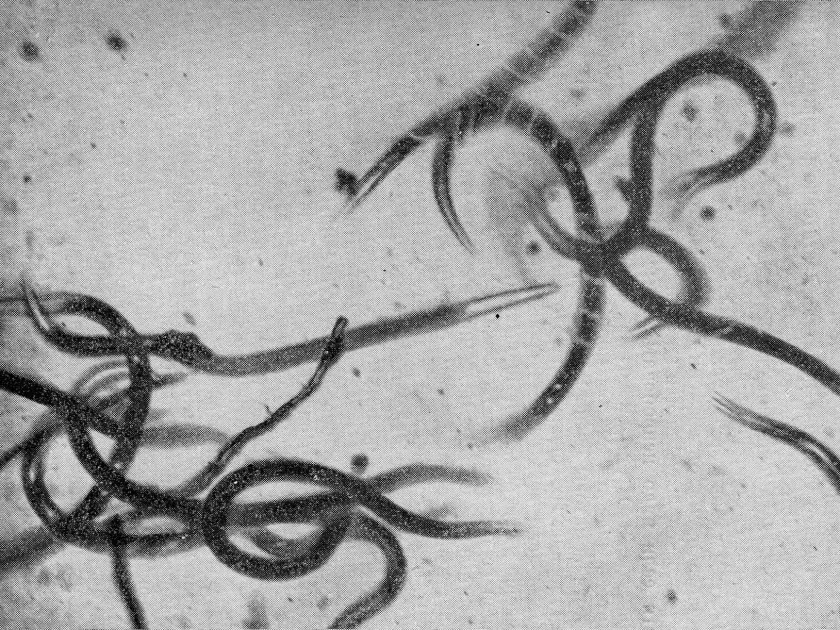 Harposporium anguillullae