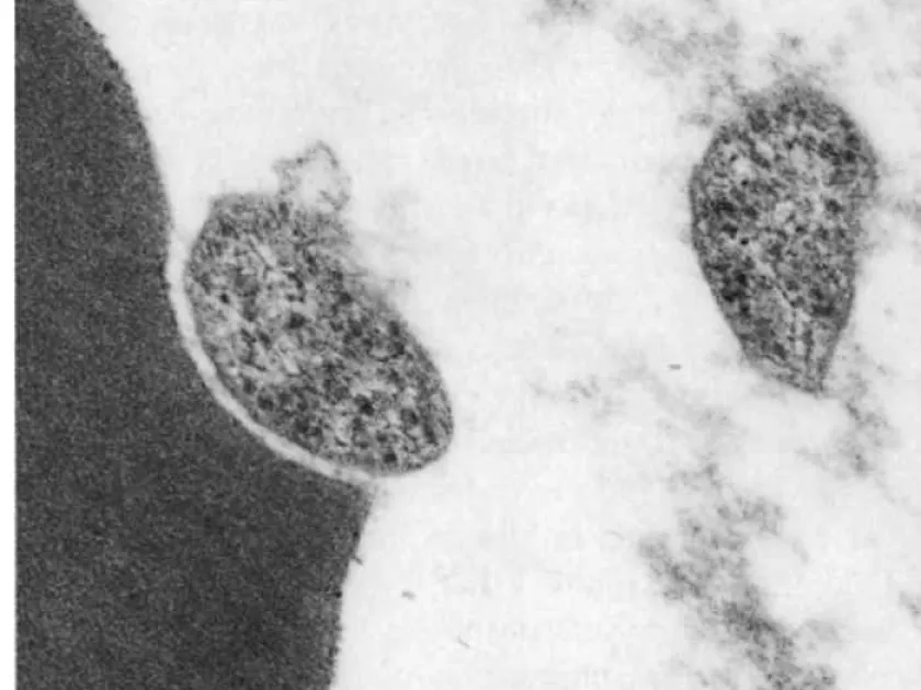 Eperythrozoonosis