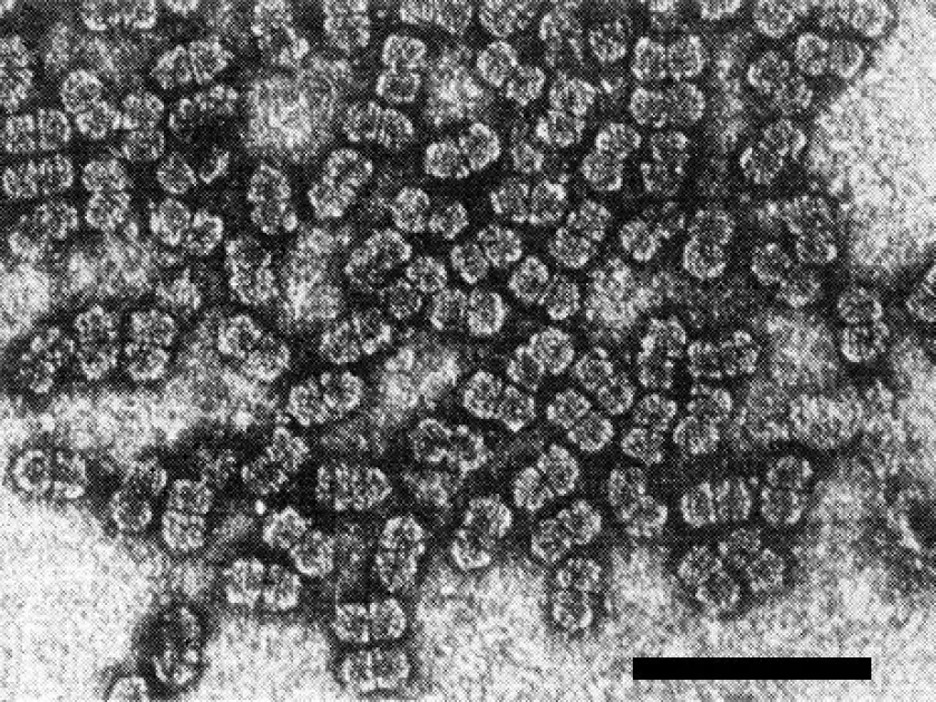 Sugarcane streak virus