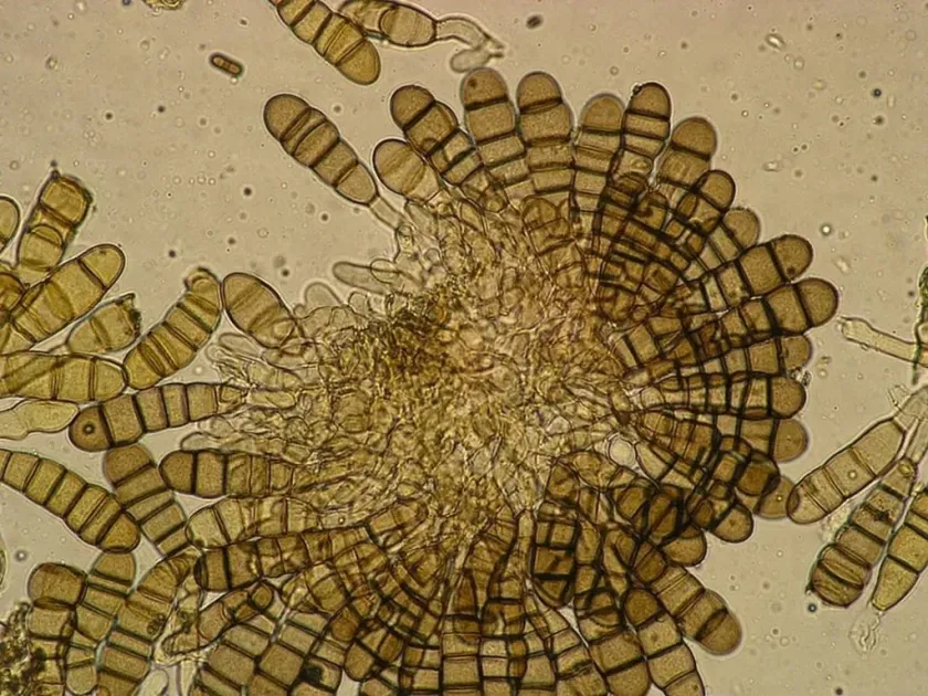 Stigmina leaf spot