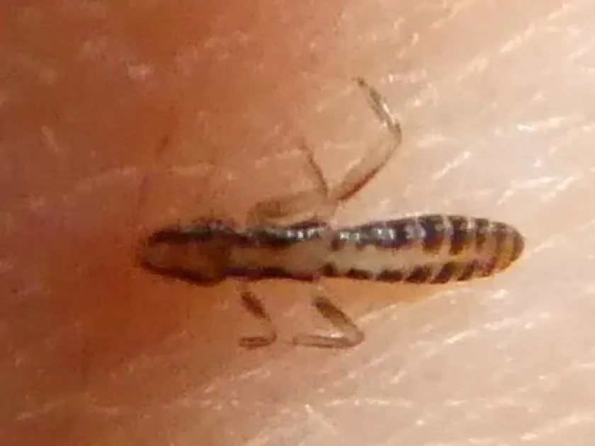 Goose louse