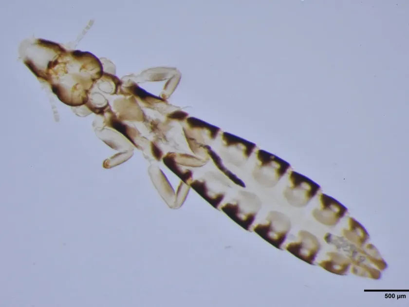 Duck louse