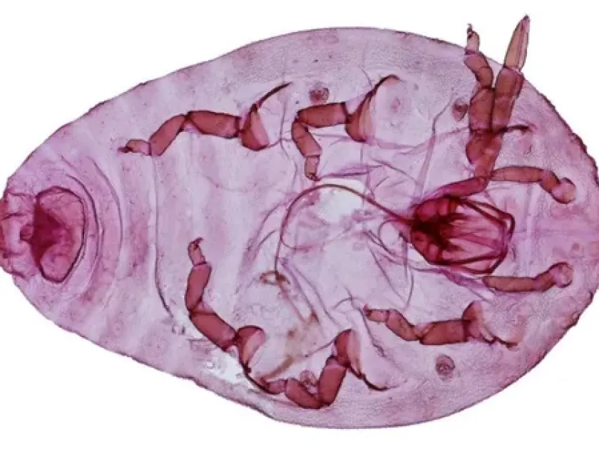 Pear phylloxera