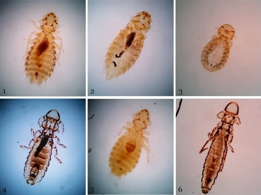 Chicken louse