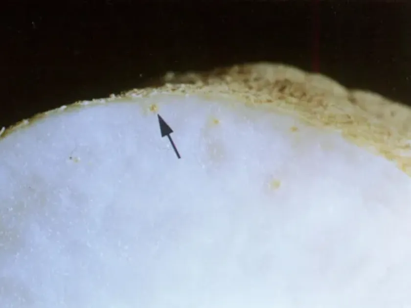 Columbia root-knot nematode