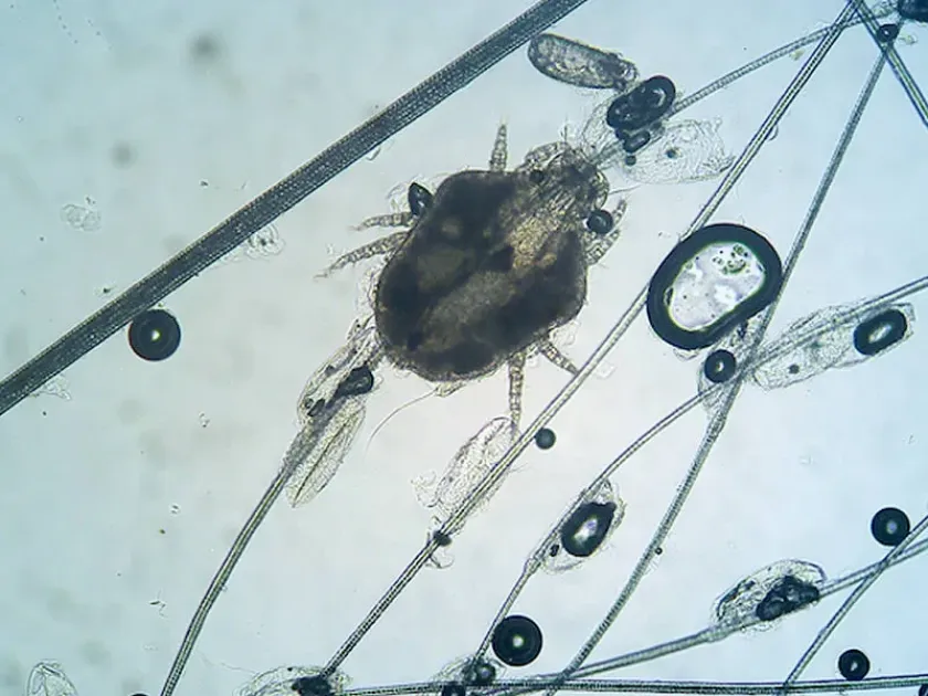 Cheyletiella mite