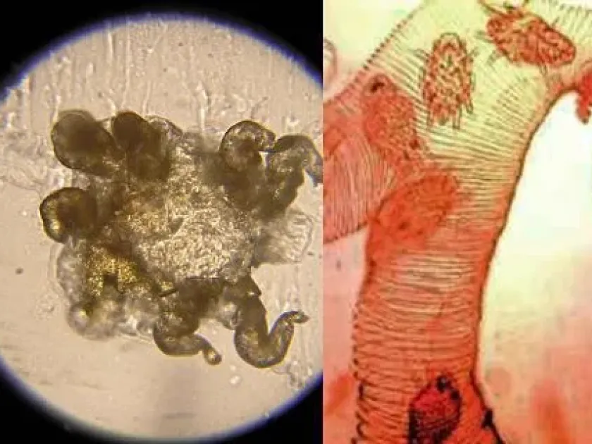 Tracheal mite