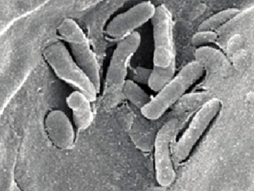 Pantoea ananatis