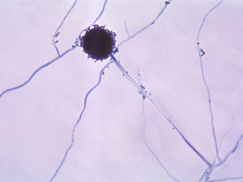 Aspergillus restrictus
