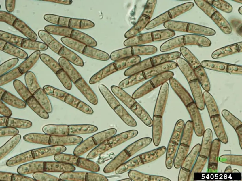 Stenocarpella maydis