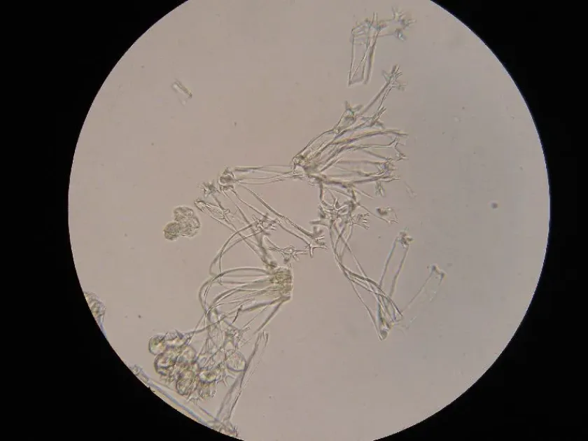 Plasmopara pygmaea